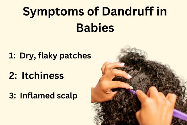 Symptoms of Dandruff in Babies