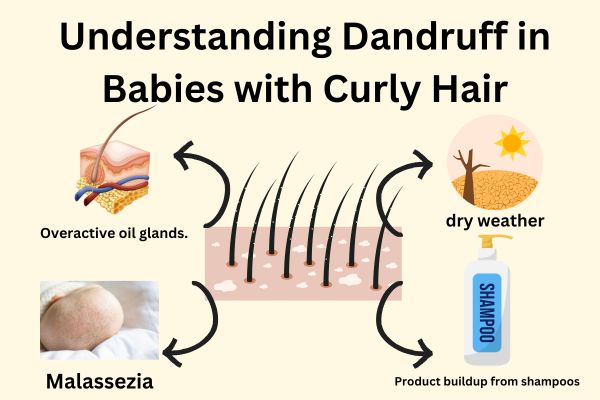 Understanding Dandruff in Babies with Curly Hair